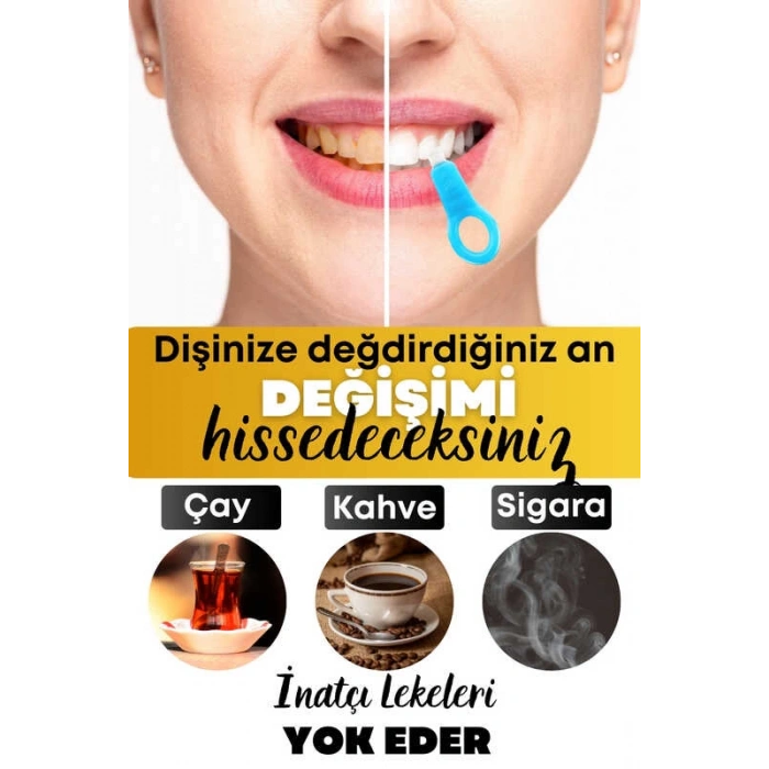 Diş  Silgisi 1 Aparatlı + 5 Yedek Süngerli Set 1 Paket