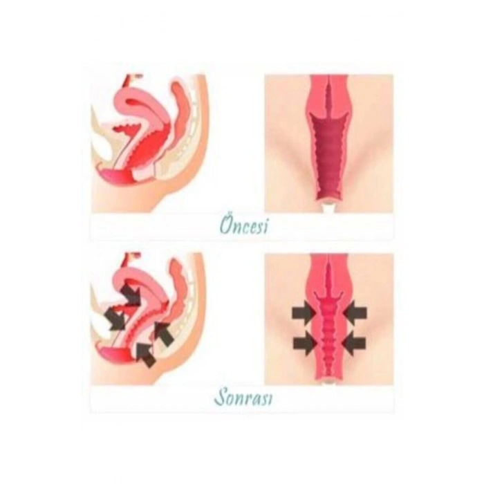 Kadınlar İçin Genital Bölge Şekillendirici Krem 100 ml X 3 ADET