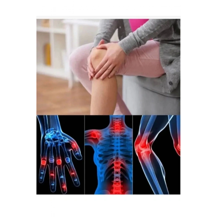 Kas Iskelet Bel Sırt Fıtık ve Eklemlerin Ağrılarına Etkili Krem