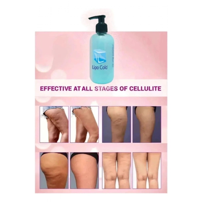 Lipo Cold Sıkılığa Inceliğe Hafifliğe Ve Selülilitlerinize Güçlü Etkide Krem 250 ml