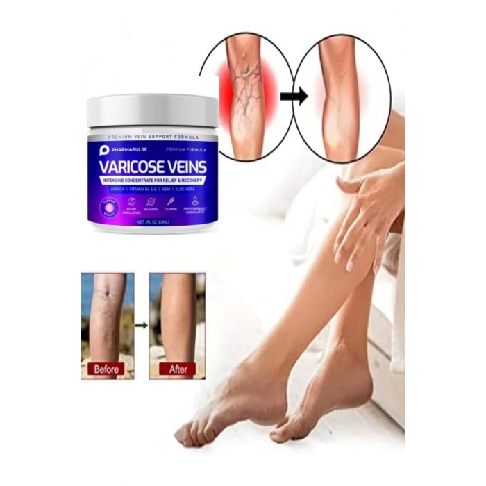 Maximum Strength Varicose Vein Var.is Bacak Bakım Masaj Kremi 100 ml