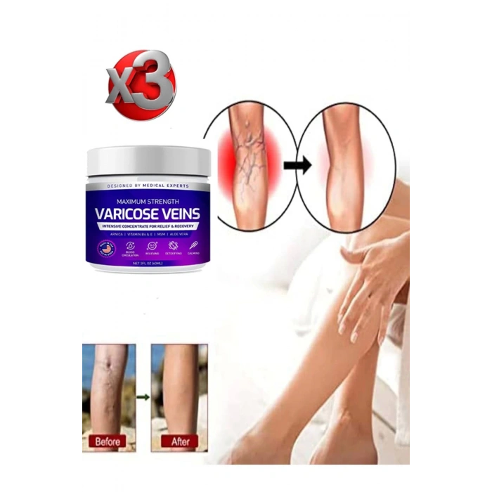 Maximum Strength Varicose Veins Bakım Kremi 100 ml x 3 adet