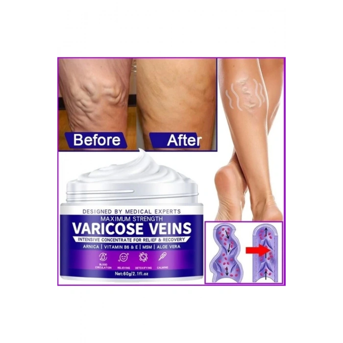 Maximum Strength Varicose Veins Krem 100 ml 1 Adt