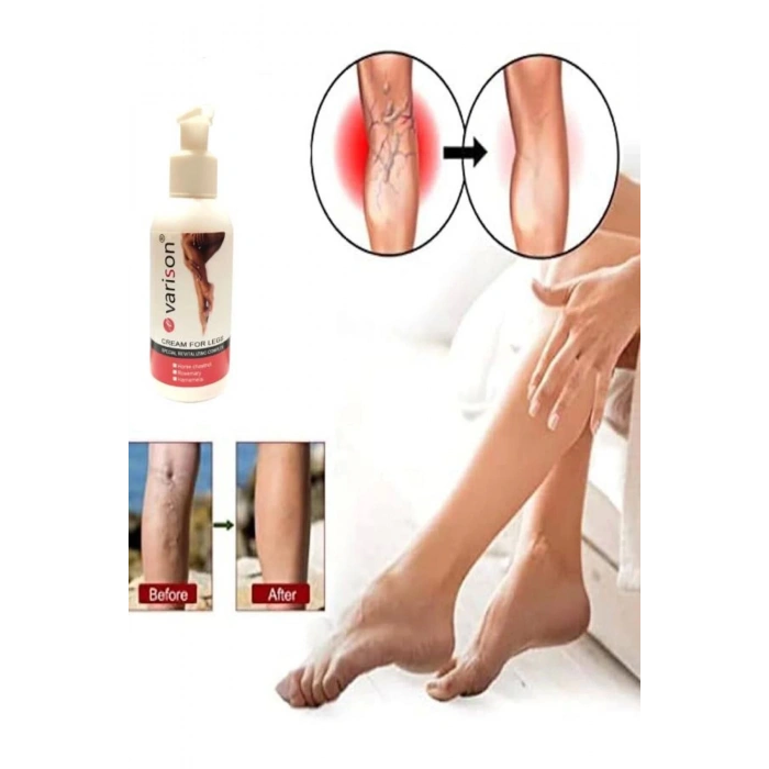 On Vari.s Sellülit Bacak Bakım Kremi 120 ml