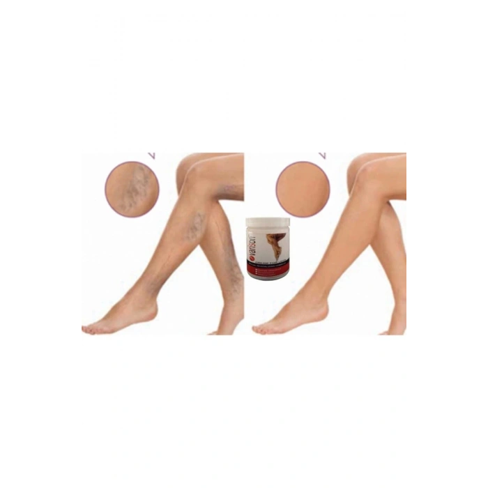 On Va.ris Selü.lit Bacak Bakım Kremi 200 ml X 2adet