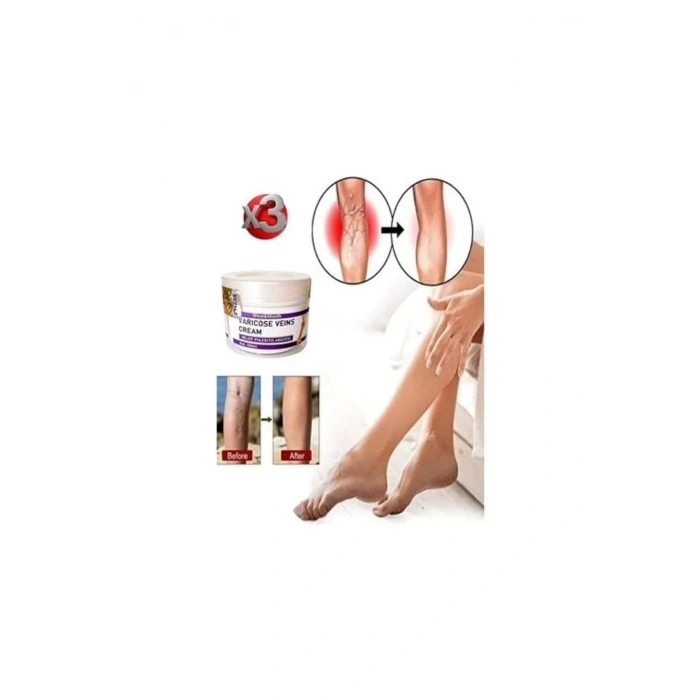 Varicose And Spider Veins Soothing Leg Cream Bacak Bakım Kremi 100 ml x 3 Adet
