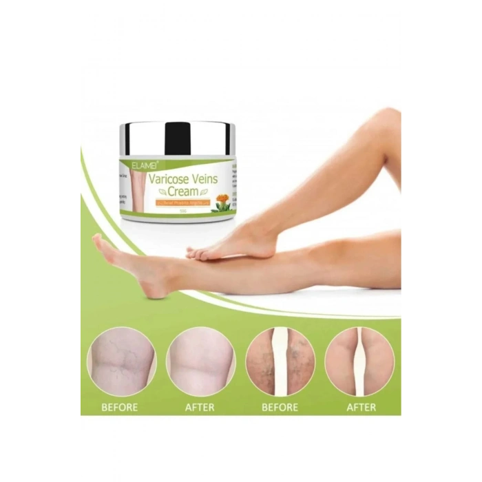 Varicose Veins Var.is Kremi 100 ML