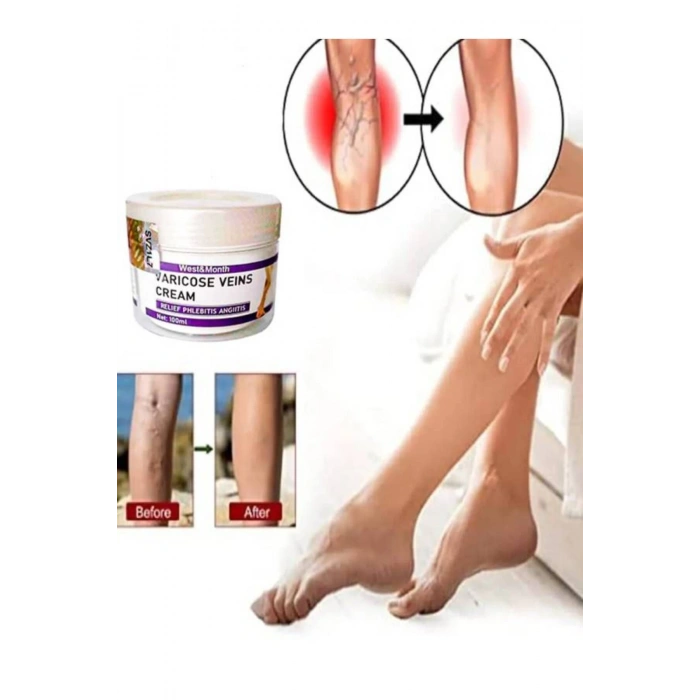 West & Month Varicose Vein Va.ris Karşıtı Kremi100 ml 2 Adet