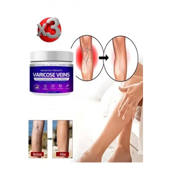 Maximum Strength Varicose Veins Bakım Kremi 100 ml x 3 adet