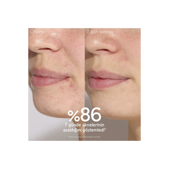 Vinopure Akne Karşıtı Salisilik Serum 30 ml