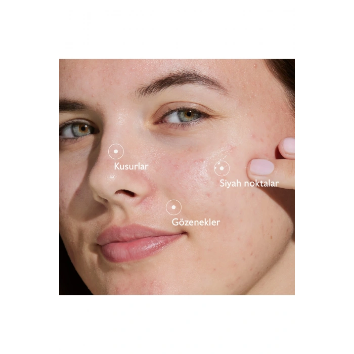 Vinopure Akne Karşıtı Salisilik Serum 30 ml