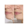 Vinopure Akne Karşıtı Salisilik Serum 30 ml