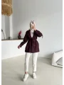 Kruvaze Yaka Trençkot-Kısa