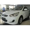 HYUNDAI ACCENT- BLUE- 11/18; ARAÇ BİLGİLERİ VE RESİMLERİ