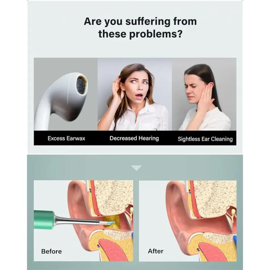 Bebırd T5 3mp Kamera 3.5mm Lens Şarjlı Wıfı Görüntülü Kulak Temizleyici Yeşil Renk