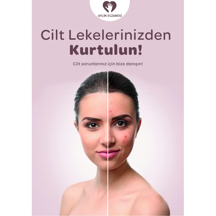 Cilt Leke  Afiş & Poster No:1