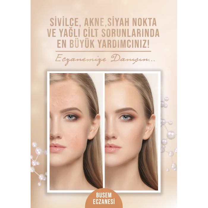 Sivilce Afiş & Poster