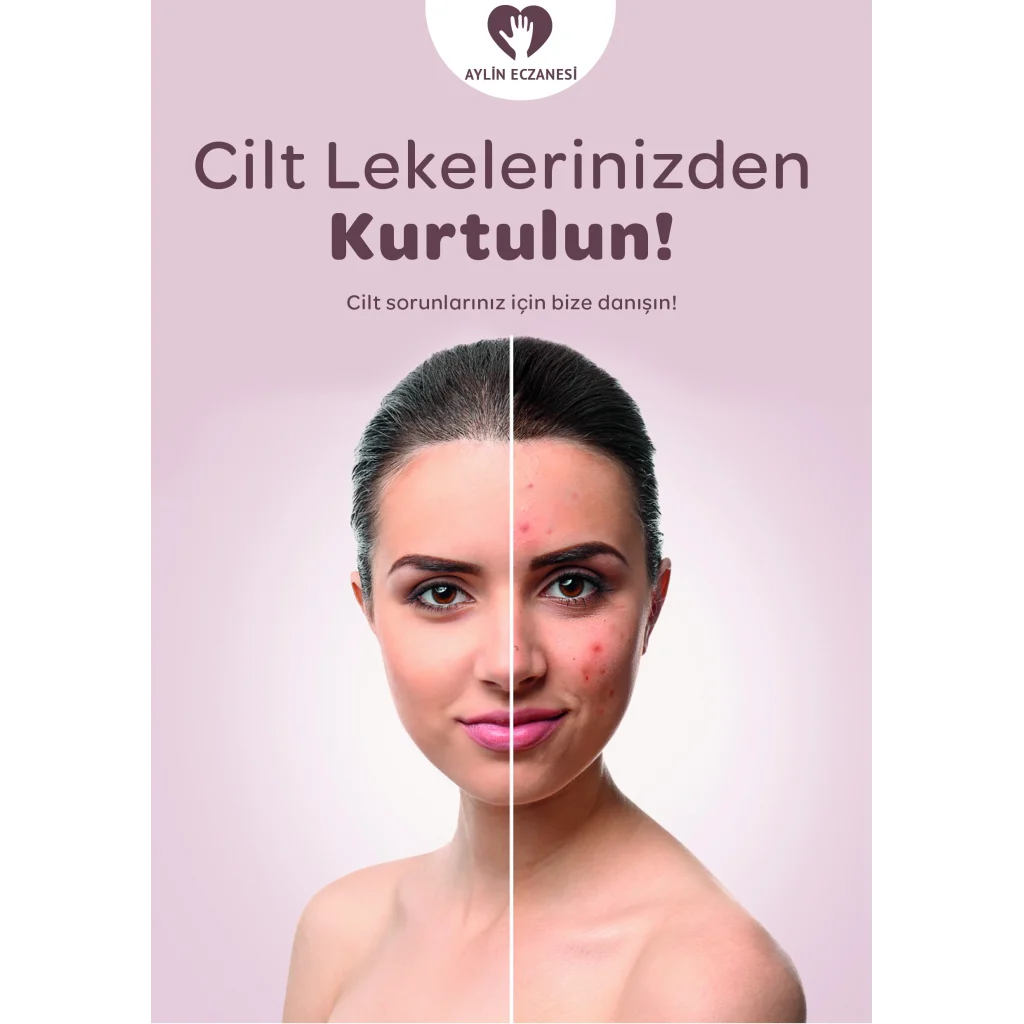 Cilt Leke Afiş & Poster No:1