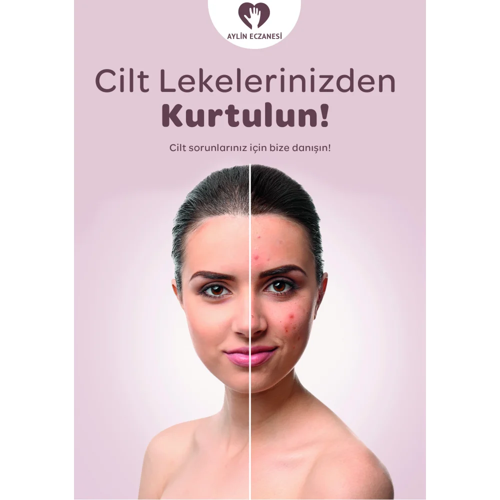 Cilt Leke Afiş & Poster No:1