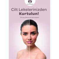 Cilt Leke Afiş & Poster No:1