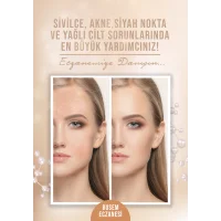 Sivilce Afiş & Poster