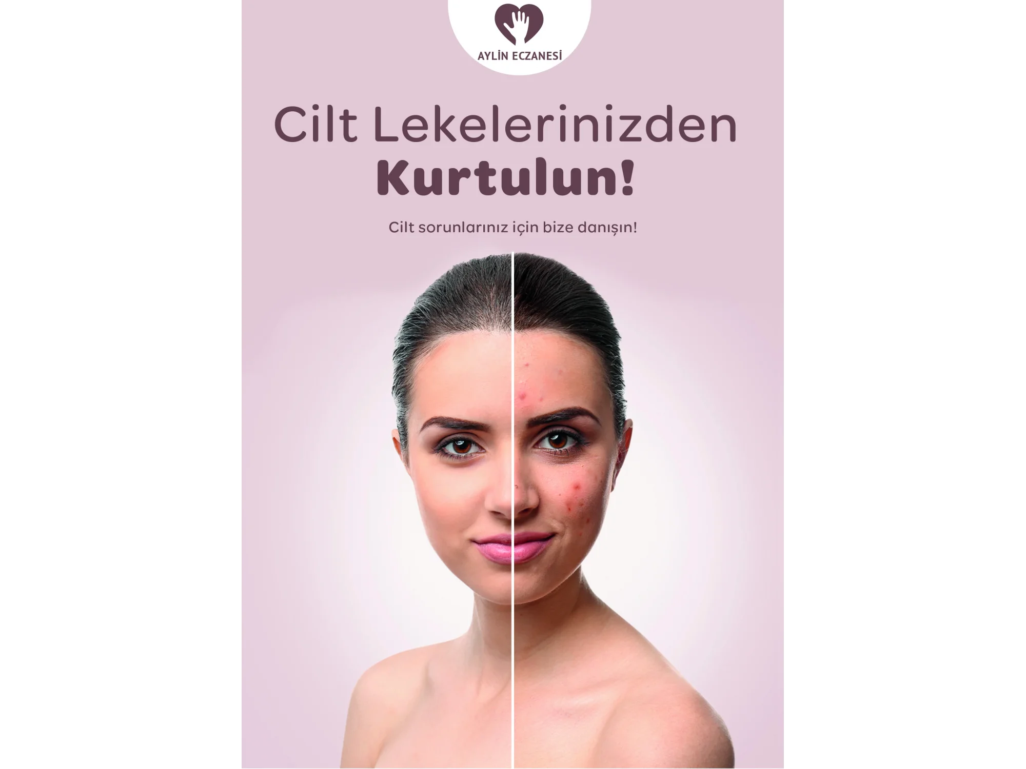 Cilt Leke Afiş & Poster No:1