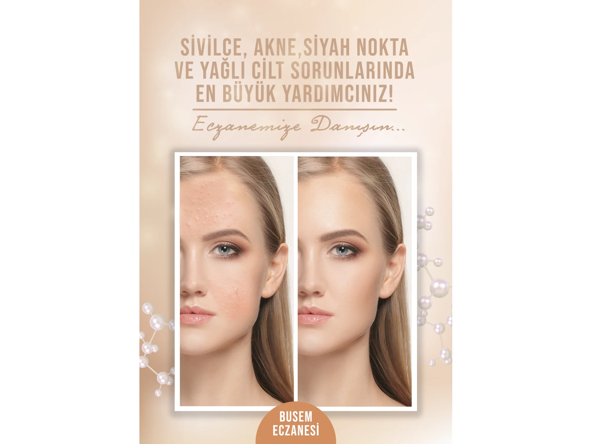 Sivilce Afiş & Poster