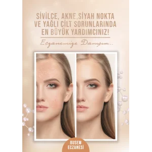 Sivilce Afiş & Poster