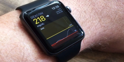 YENİ APPLE WATCHLAR SAĞLIK TARAFINDA FARK YARATACAK