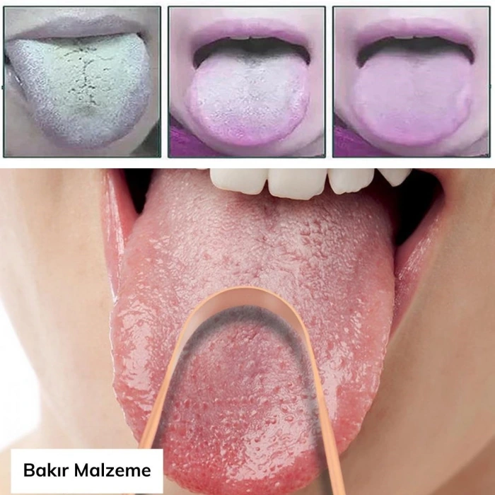 İpek Yıldızı® Bakır Oil Pulling Yağ Çekme Dil Plak Temizleme Aleti Dil Fırçası Sıyırıcı Dil Kaşığı