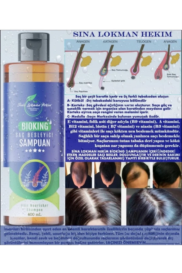 BioKing Saç Besleyici Şampuan – 400 ml | Dökülme Karşıtı ve Kepeğe Etkili
