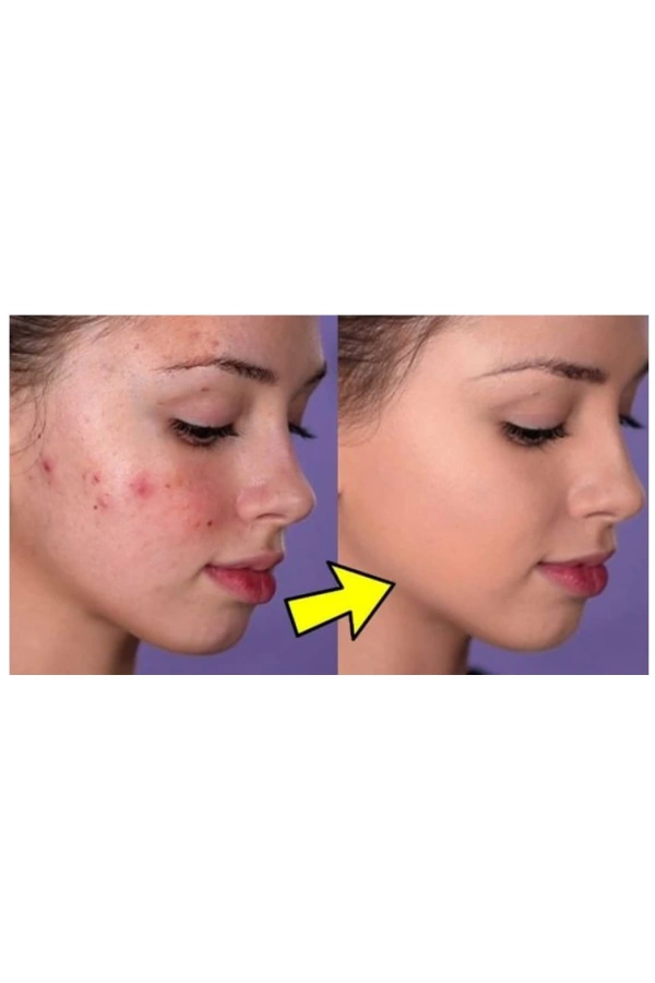 Sarı Kantaron Özlü Krem – 250 ml | Cilt Yenileyici ve Onarıcı