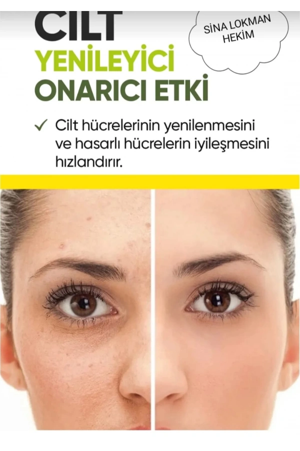 Sarı Kantaron Özlü Krem – 250 ml | Cilt Yenileyici ve Onarıcı