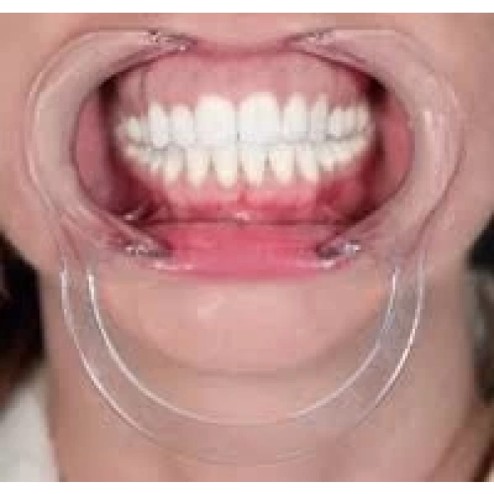 MOUL RETRACTOR