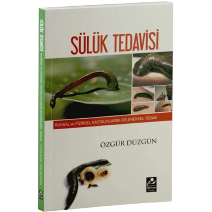 SÜLÜK TEDAVİSİ KİTABI - Özgür DÜZGÜN