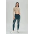 Kadın Skinny Fit Yüksek Bel Jeans Yıpratmalı Lacivert