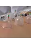 Kupa Çekme Hacamat Seti 6 Adet