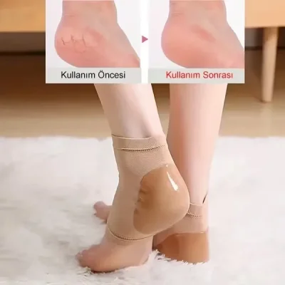 1 Çift Silikon Nemlendirici Topuk Çorabı Çatlak Nasır İçin Nemlendirici Topuk Çatlak Girerici Çorap