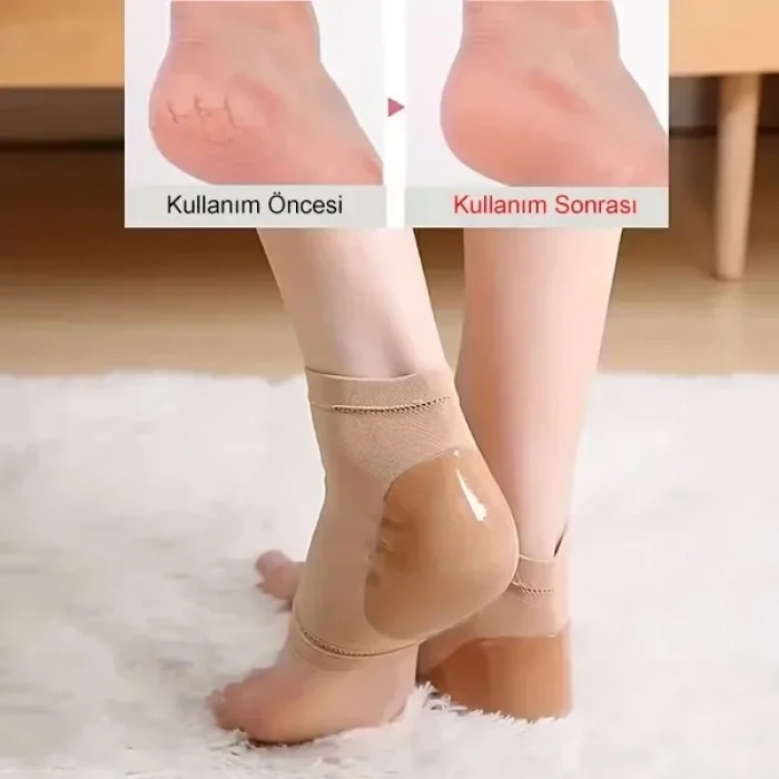 1 Çift Silikon Nemlendirici Topuk Çorabı Çatlak Nasır İçin Nemlendirici Topuk Çatlak Girerici Çorap