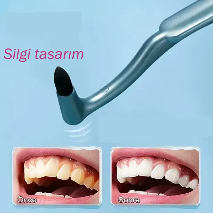 Diş Lekesi Temizleme Fırçası ve Diş Taşını Giderirci Fırça