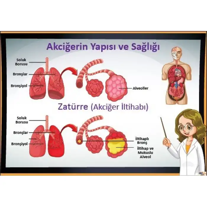 Akciğerin Yapısı ve Zatürre Afişi