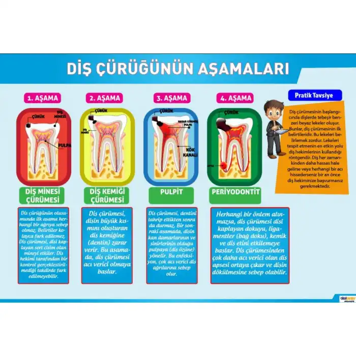 Diş Çürüğünün Aşamaları