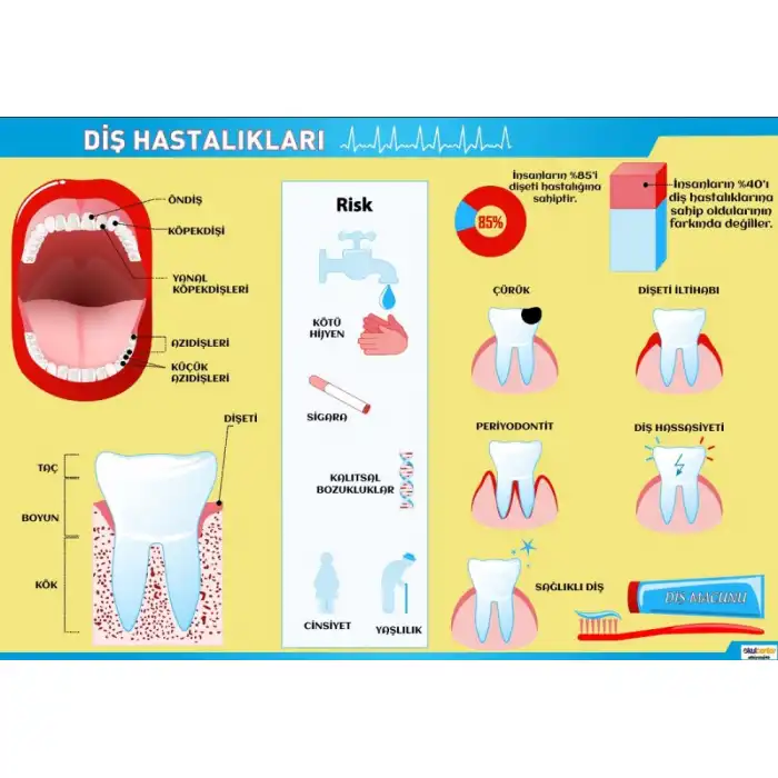 Diş Hastalıkları Posteri