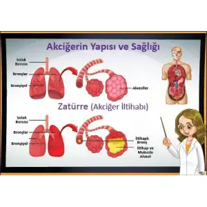 Akciğerin Yapısı ve Zatürre Afişi