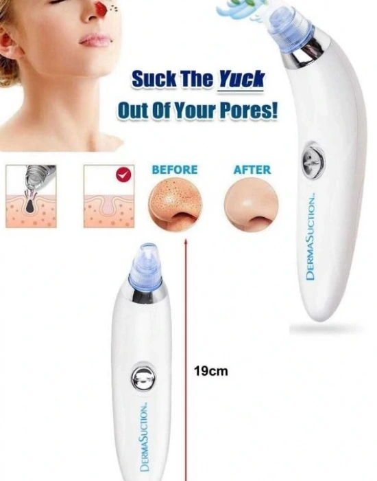 Pilli Derma Suction Vakumlu Siyah Nokta Yüz Temizleme Cihazı