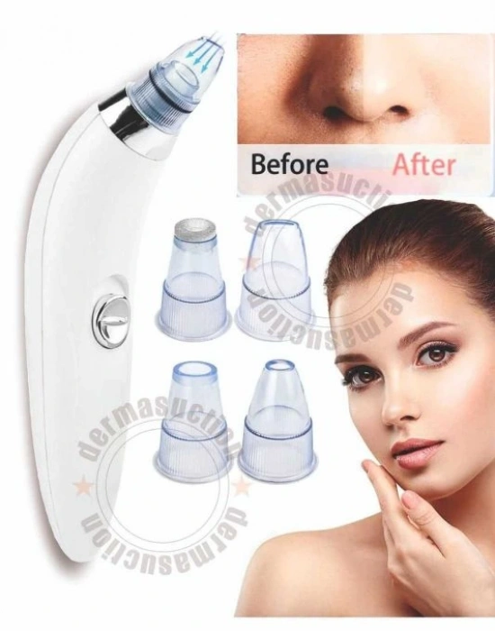 Pilli Derma Suction Vakumlu Siyah Nokta Yüz Temizleme Cihazı