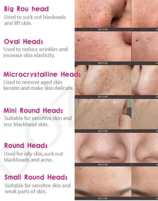 Sarjlı Vakumlu Siyah Nokta Temizleme Cihazı Akne Cilt Yüz Temizleme Cihazı 3 Modlu Şarjlı 6 Başlıklı
