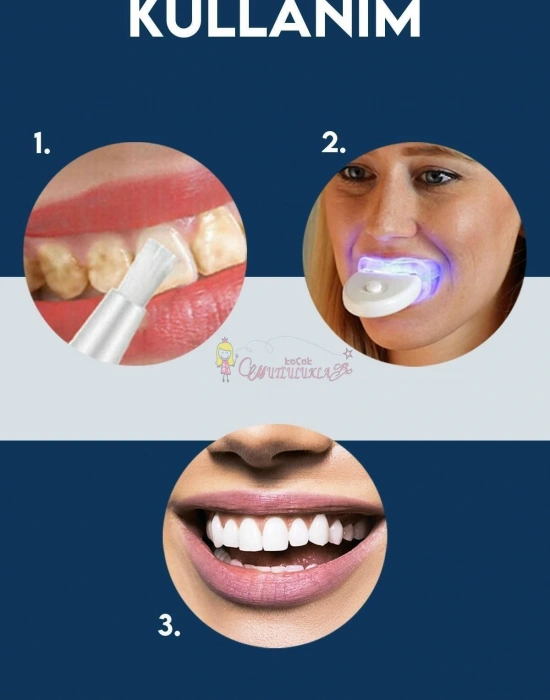 Mavi Işık Teknolojisi Ile Diş Beyazlatma Kiti & Beyazlatıcı Diş Kalemi Seti