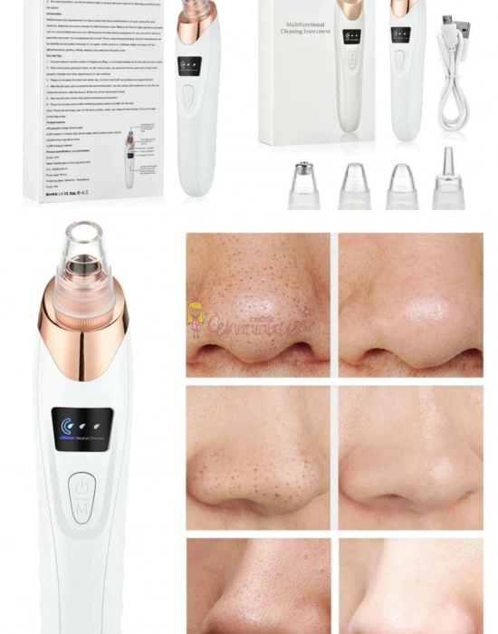 Vakumlu Yüz Temizleme Cihazı Siyah Nokta 5 Başlıklı Şarjlı Şık Tasarım Taşınabilir Pratik Bakım Seti