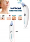 Pilli Derma Suction Vakumlu Siyah Nokta Yüz Temizleme Cihazı